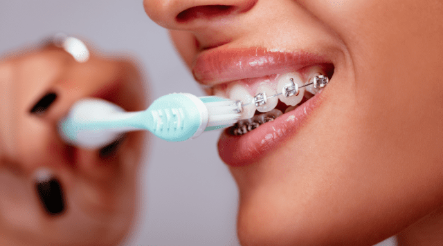 brush your teeth with braces