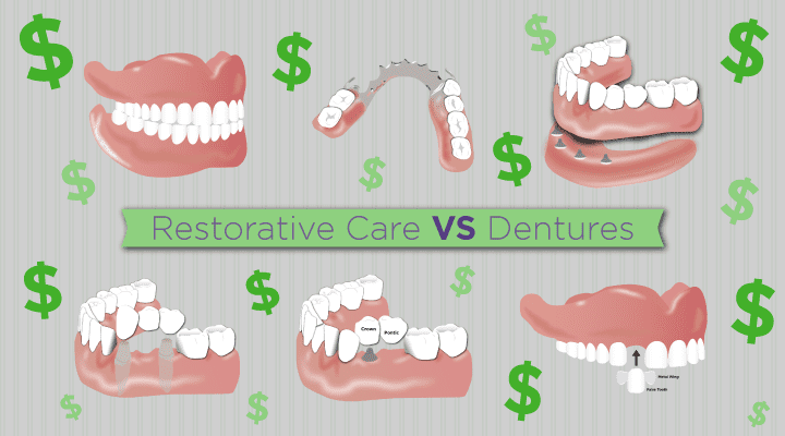 Are Dentures Covered by Delta Dental?