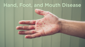 Learn to recognize the symptoms of hand, foot, and mouth disease and how to take action if your child is affected.