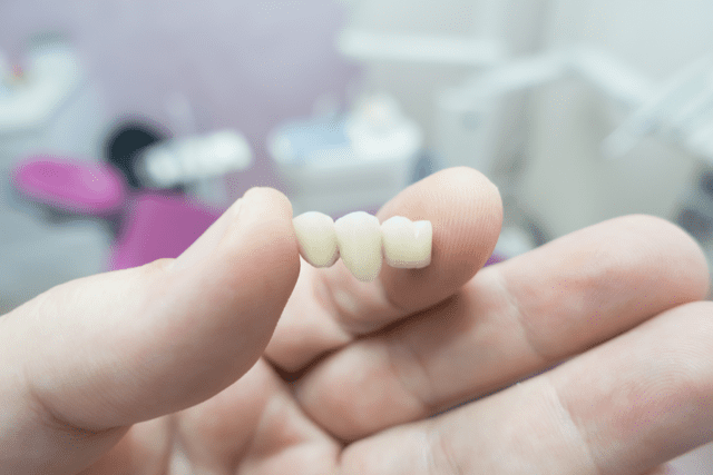 What is a dental bridge? What is a dental bridge procedure? What types of dental bridges are there? Get answers to these and many more questions in this informational dental bridge article.