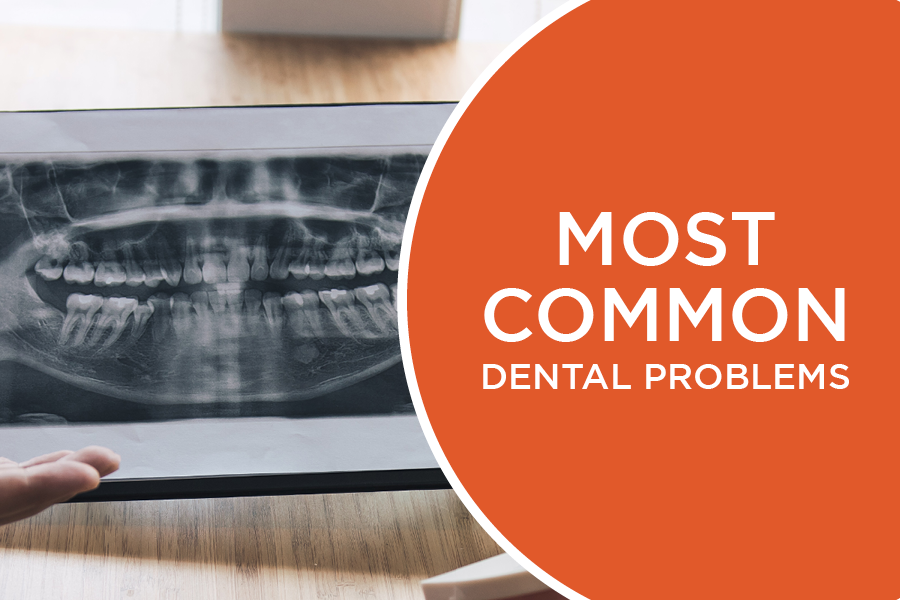 Learn about some of the most common dental problems people have and ways to prevent them.