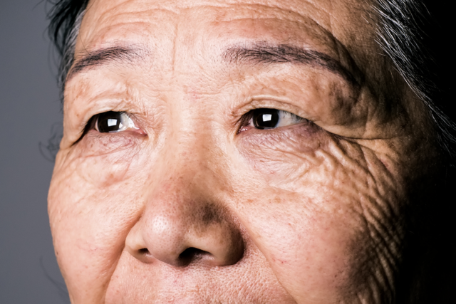 A close up of an older adults face, including the eyes and nose.